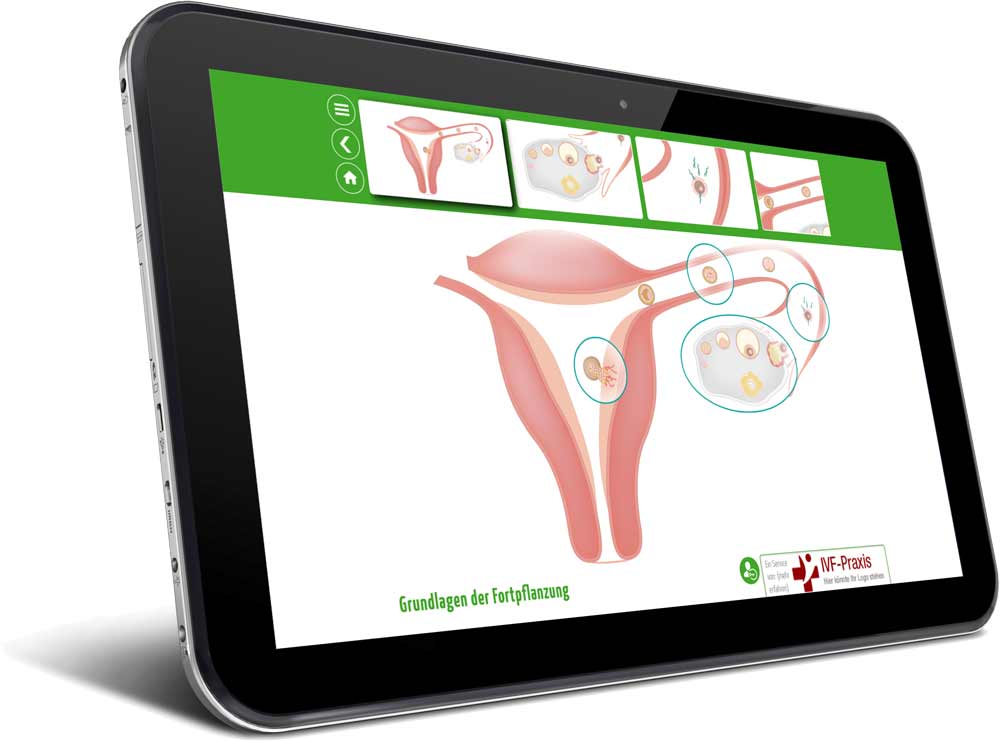 ivf-app-in-tablet